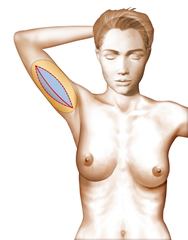 lifting bras