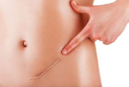 photo chirurgie cutanee