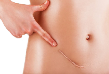 photo chirurgie cutanee2
